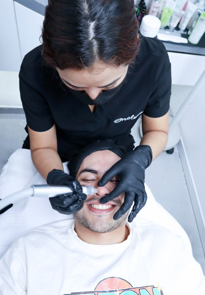 Servicio de limpieza facial profunda + dermapen by Oneline Spa