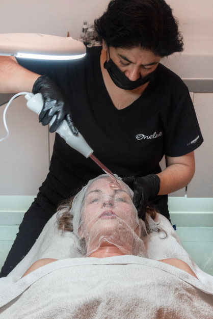 Limpieza facial profunda
